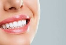 Teeth Whitening: Quick Tips for a Bright Valentine's Day Smile