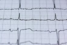 infinite pulse brand flow 665633839